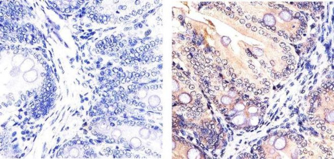 SMAD7 Antibody in Immunohistochemistry (Paraffin) (IHC (P))