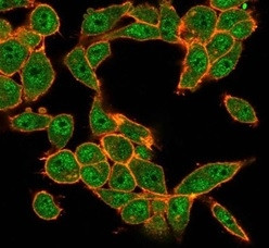 MEF2D/Myocyte enhancer factor 2D (Transcription Factor) Antibody in Immunocytochemistry (ICC/IF)