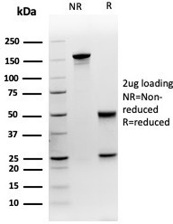 MEF2D/Myocyte enhancer factor 2D (Transcription Factor) Antibody in SDS-PAGE (SDS-PAGE)