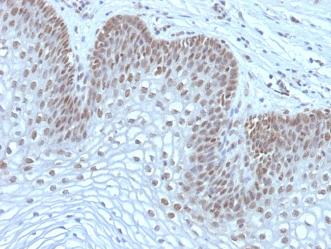 MAP3K1 (Mitogen-Activated Protein Kinase Kinase Kinase 1) Antibody in Immunohistochemistry (Paraffin) (IHC (P))