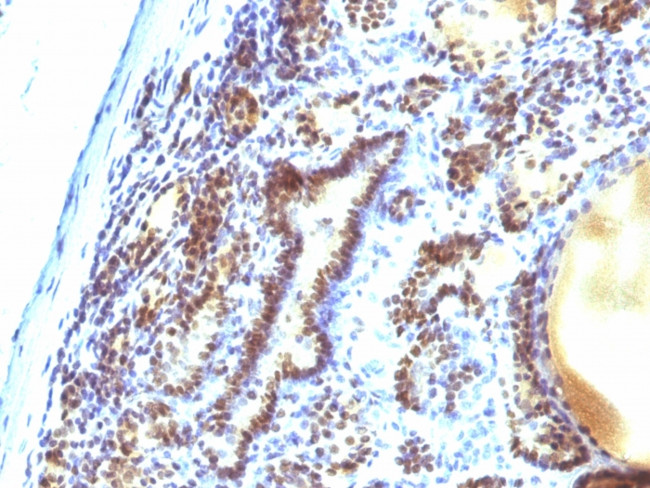 MAP3K1 (Mitogen-Activated Protein Kinase Kinase Kinase 1) Antibody in Immunohistochemistry (Paraffin) (IHC (P))