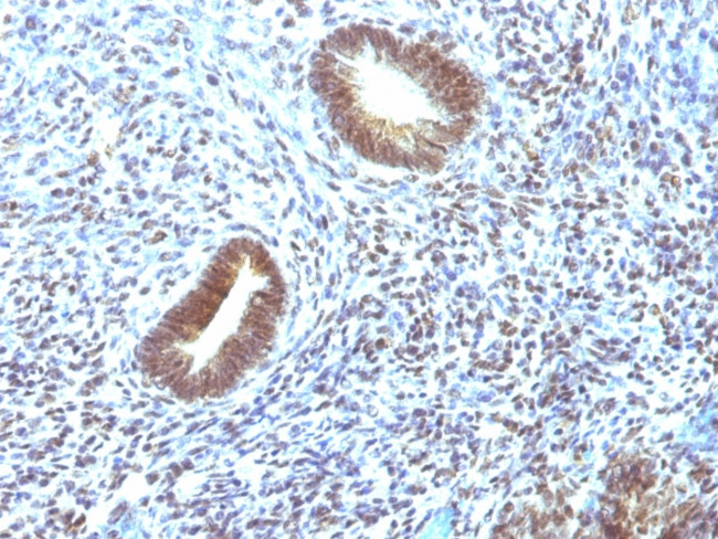 MAP3K1 (Mitogen-Activated Protein Kinase Kinase Kinase 1) Antibody in Immunohistochemistry (Paraffin) (IHC (P))