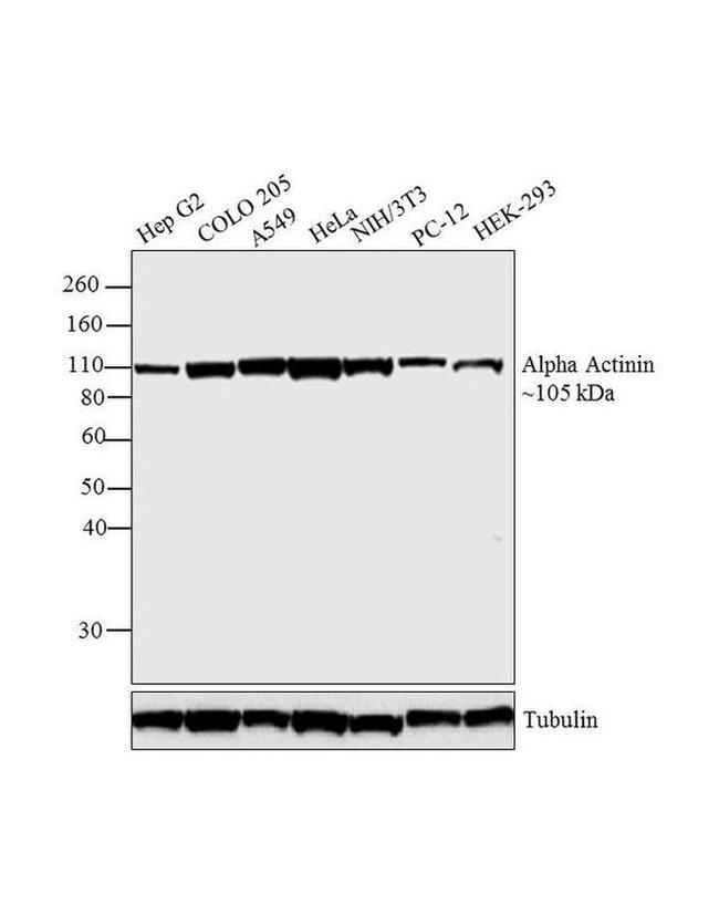 alpha Actinin 4 Antibody in Western Blot (WB)