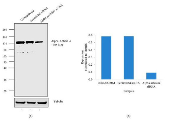 alpha Actinin 4 Antibody