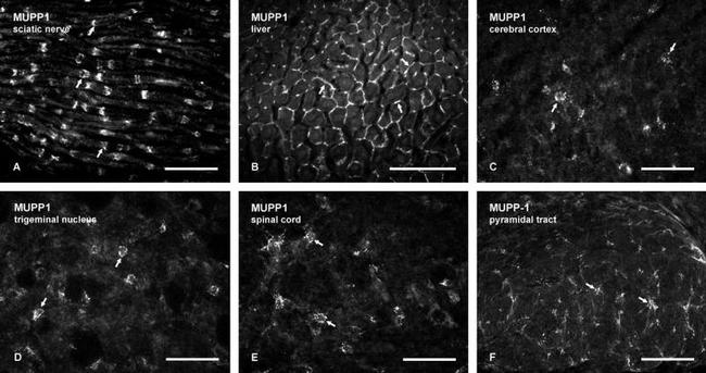 MUPP1 Antibody in Immunocytochemistry (ICC/IF)