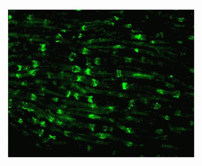 MUPP1 Antibody in Immunohistochemistry (IHC)