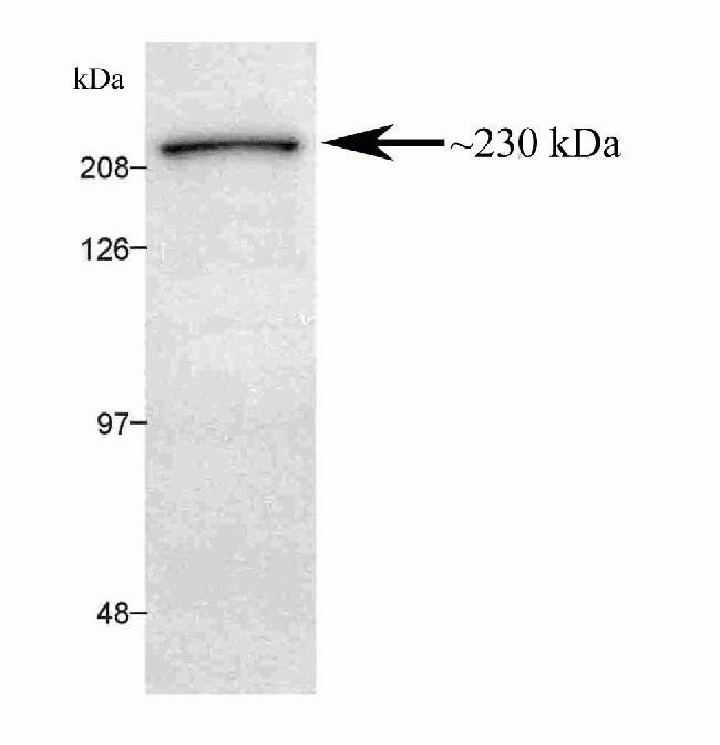 MUPP1 Antibody in Western Blot (WB)