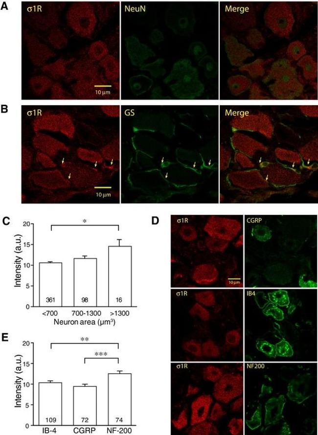 Sigma-1 Receptor Antibody in Immunohistochemistry (IHC)