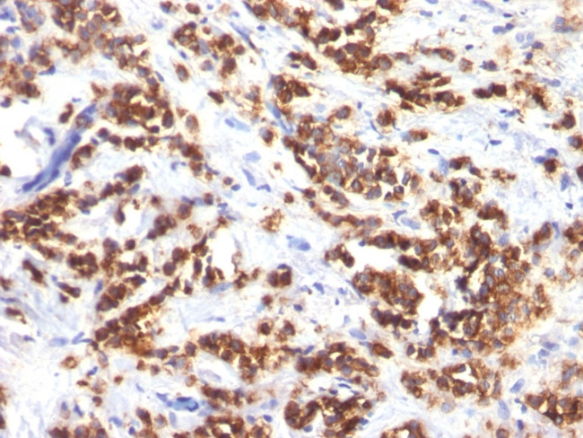 Milk Fat Globule (Breast Epithelial Marker) Antibody in Immunohistochemistry (Paraffin) (IHC (P))