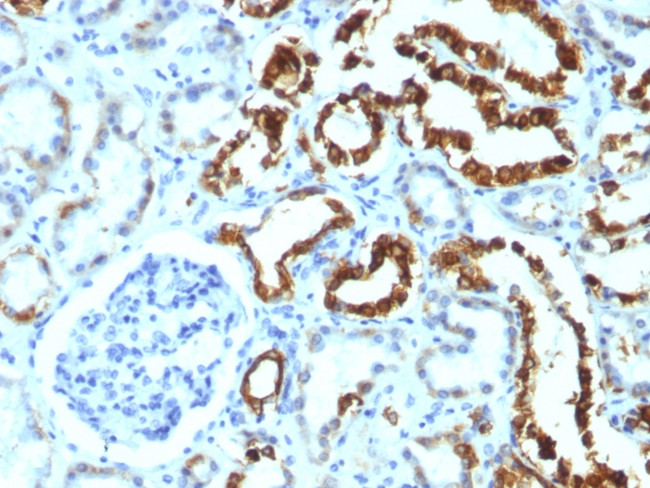 Milk Fat Globule (Breast Epithelial Marker) Antibody in Immunohistochemistry (Paraffin) (IHC (P))