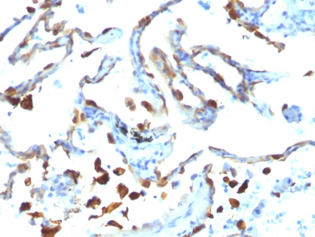 Milk Fat Globule (Breast Epithelial Marker) Antibody in Immunohistochemistry (Paraffin) (IHC (P))