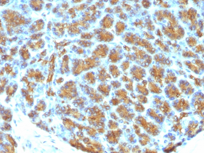 Milk Fat Globule (Breast Epithelial Marker) Antibody in Immunohistochemistry (Paraffin) (IHC (P))