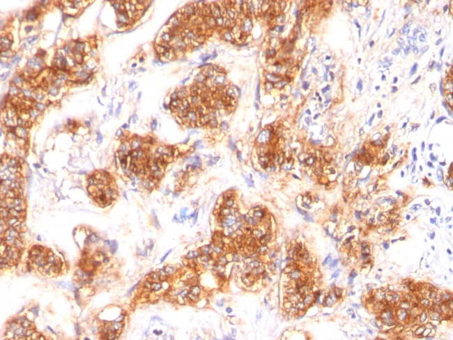 Milk Fat Globule (Breast Epithelial Marker) Antibody in Immunohistochemistry (Paraffin) (IHC (P))