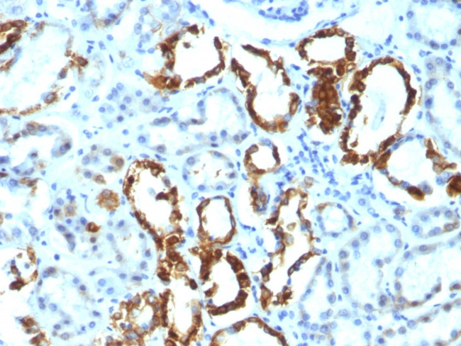 Milk Fat Globule (Breast Epithelial Marker) Antibody in Immunohistochemistry (Paraffin) (IHC (P))