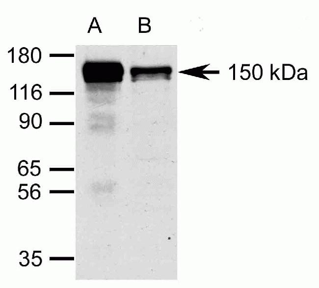 Raptor Antibody in Immunoprecipitation (IP)