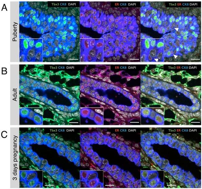 TBX3 Antibody in Immunohistochemistry (Paraffin) (IHC (P))