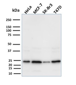 Mammaglobin (SCGB2A2) (Breast Cancer Marker) Antibody in Western Blot (WB)