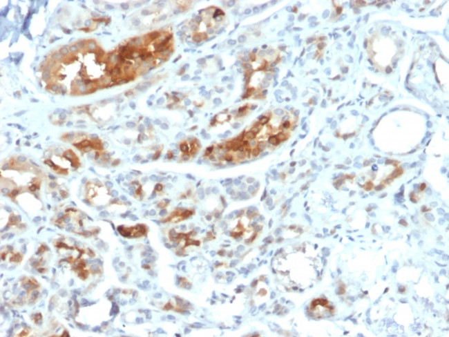 Mammaglobin (SCGB2A2) (Breast Cancer Marker) Antibody in Immunohistochemistry (Paraffin) (IHC (P))