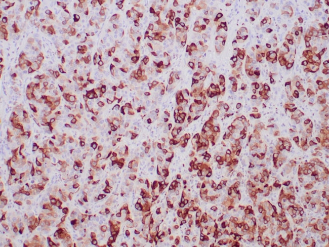 Mammaglobin (SCGB2A2) (Breast Cancer Marker) Antibody in Immunohistochemistry (Paraffin) (IHC (P))