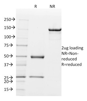 Mammaglobin (SCGB2A2) (Breast Cancer Marker) Antibody in SDS-PAGE (SDS-PAGE)