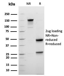 Mammaglobin (SCGB2A2) (Breast Cancer Marker) Antibody in SDS-PAGE (SDS-PAGE)