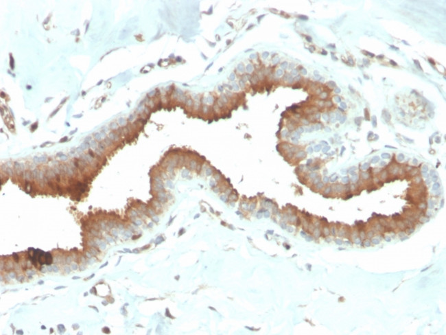 Mammaglobin (SCGB2A2) (Breast Cancer Marker) Antibody in Immunohistochemistry (Paraffin) (IHC (P))