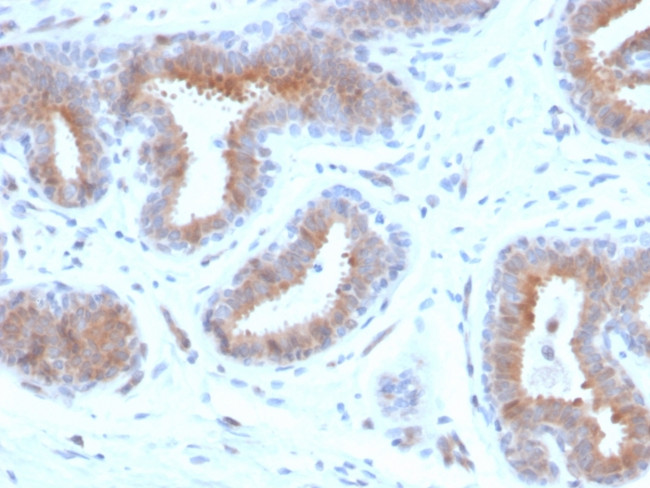 Mammaglobin (SCGB2A2) (Breast Cancer Marker) Antibody in Immunohistochemistry (Paraffin) (IHC (P))