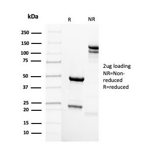 Mammaglobin (SCGB2A2) (Breast Cancer Marker) Antibody in SDS-PAGE (SDS-PAGE)