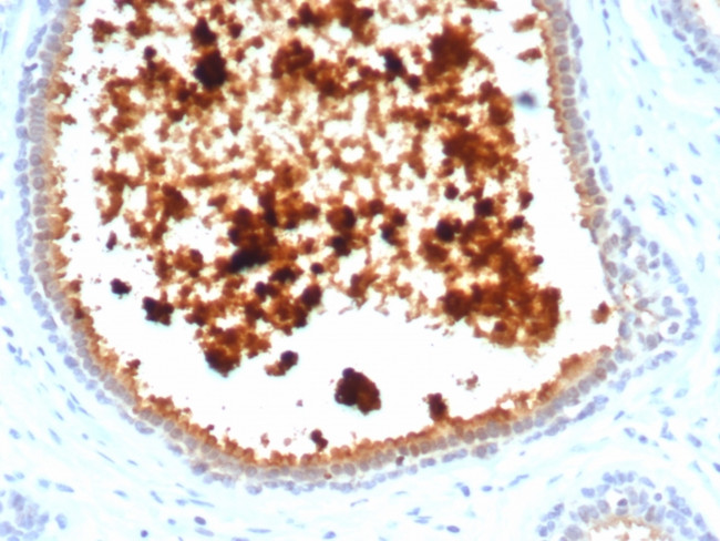 Mammaglobin (SCGB2A2) (Breast Cancer Marker) Antibody in Immunohistochemistry (Paraffin) (IHC (P))