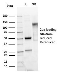 Mammaglobin (SCGB2A2) (Breast Cancer Marker) Antibody in SDS-PAGE (SDS-PAGE)