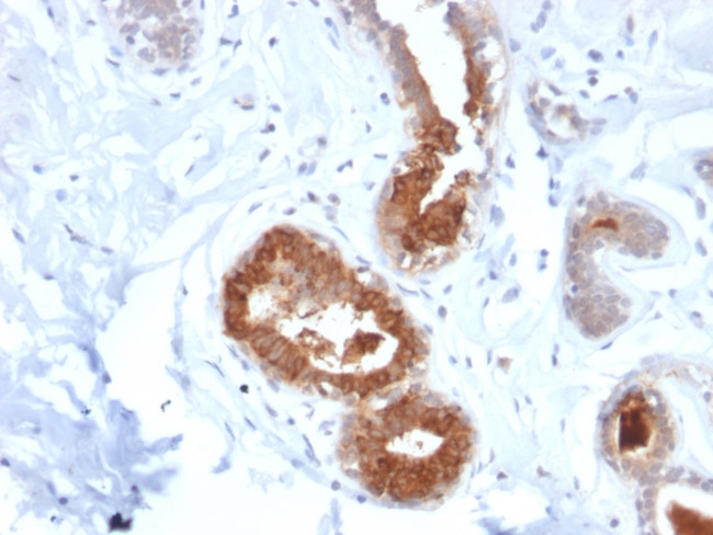 Mammaglobin (SCGB2A2) (Breast Cancer Marker) Antibody in Immunohistochemistry (Paraffin) (IHC (P))