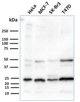 Mammaglobin (SCGB2A2) (Breast Cancer Marker) Antibody in Western Blot (WB)