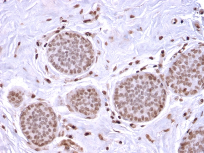 Mammaglobin (SCGB2A2) (Breast Cancer Marker) Antibody in Immunohistochemistry (Paraffin) (IHC (P))