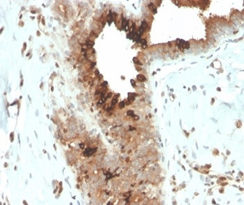 Mammaglobin (SCGB2A2) (Breast Cancer Marker) Antibody in Immunohistochemistry (Paraffin) (IHC (P))