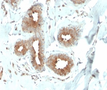 Mammaglobin (SCGB2A2) (Breast Cancer Marker) Antibody in Immunohistochemistry (Paraffin) (IHC (P))