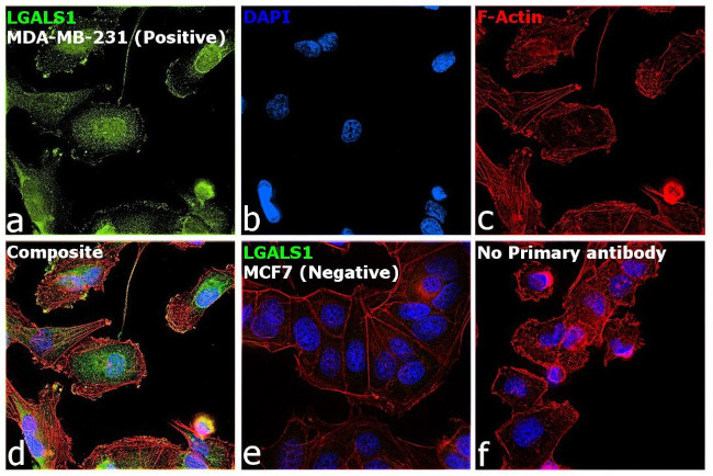 Galectin 1 Antibody