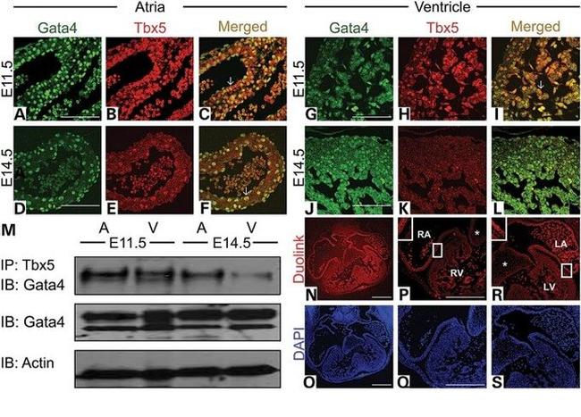 TBX5 Antibody in Immunohistochemistry, Immunoprecipitation (IHC, IP)