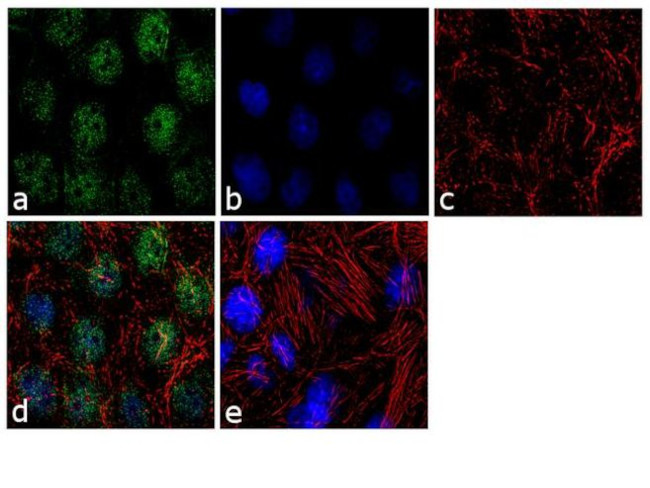 TBX5 Antibody in Immunocytochemistry (ICC/IF)