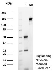 MIF (Macrophage Migration Inhibitory Factor) Antibody in SDS-PAGE (SDS-PAGE)