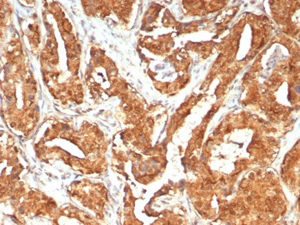 MIF (Macrophage Migration Inhibitory Factor) Antibody in Immunohistochemistry (Paraffin) (IHC (P))