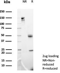 MIF (Macrophage Migration Inhibitory Factor) Antibody in SDS-PAGE (SDS-PAGE)