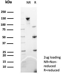 MIF (Macrophage Migration Inhibitory Factor) Antibody in SDS-PAGE (SDS-PAGE)