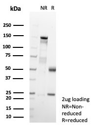 MIF (Macrophage Migration Inhibitory Factor) Antibody in SDS-PAGE (SDS-PAGE)