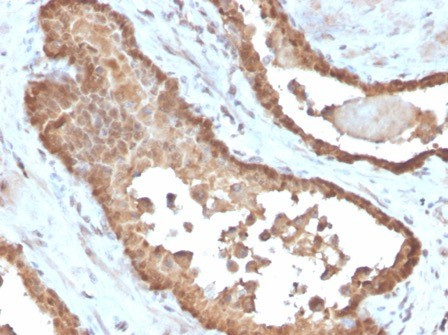 MIF (Macrophage Migration Inhibitory Factor) Antibody in Immunohistochemistry (Paraffin) (IHC (P))