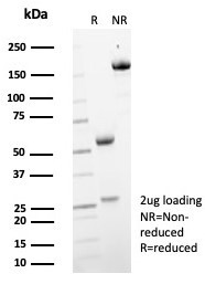 MIF (Macrophage Migration Inhibitory Factor) Antibody in SDS-PAGE (SDS-PAGE)
