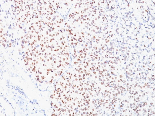 Microphthalmia Transcription Factor (MITF) Antibody in Immunohistochemistry (Paraffin) (IHC (P))