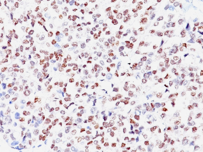 Microphthalmia Transcription Factor (MITF) Antibody in Immunohistochemistry (Paraffin) (IHC (P))