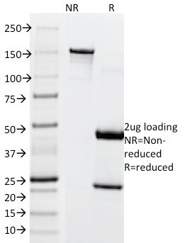 Microphthalmia Transcription Factor (MITF) Antibody in SDS-PAGE (SDS-PAGE)