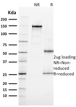 Microphthalmia Transcription Factor (MITF) Antibody in SDS-PAGE (SDS-PAGE)