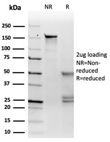 Microphthalmia Transcription Factor (MITF) Antibody in SDS-PAGE (SDS-PAGE)